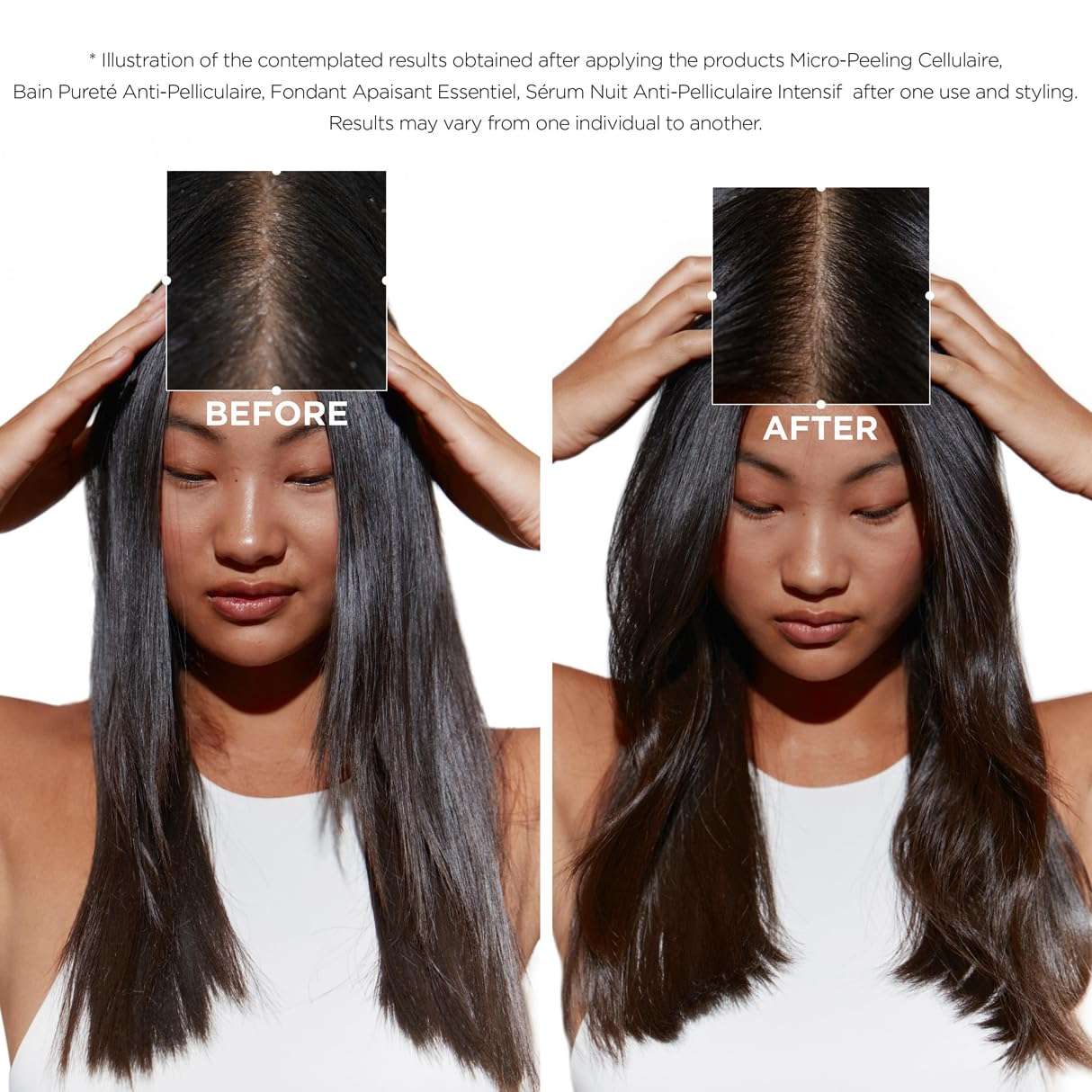 Before and after results of Keratase Anti-Dandruff Shampoo UAE showing improved scalp health and hair shine