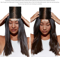 Keratase Anti-Dandruff Shampoo UAE results shown with before and after images of healthy, shiny hair