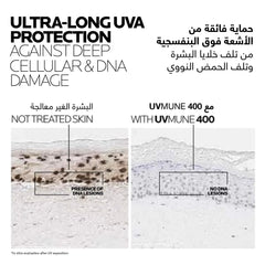 Comparison of skin damage highlighting La Roche-Posay Anthelios UVMune 400 sunscreen SPF 50+ effectiveness against UV harm