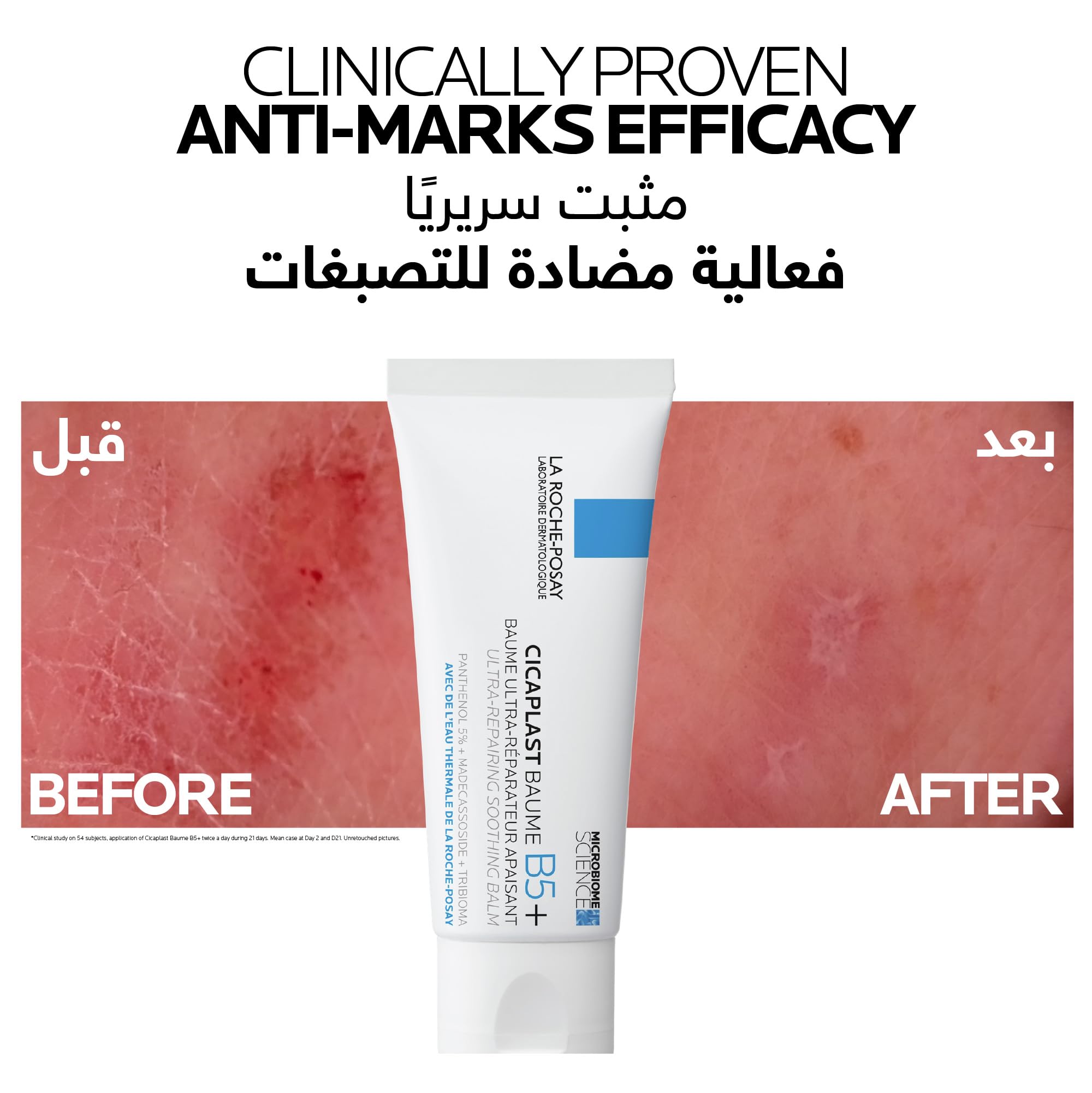 La Roche Posay Cicaplast Baume B5 UAE in tube with before and after images showing marked skin improvements