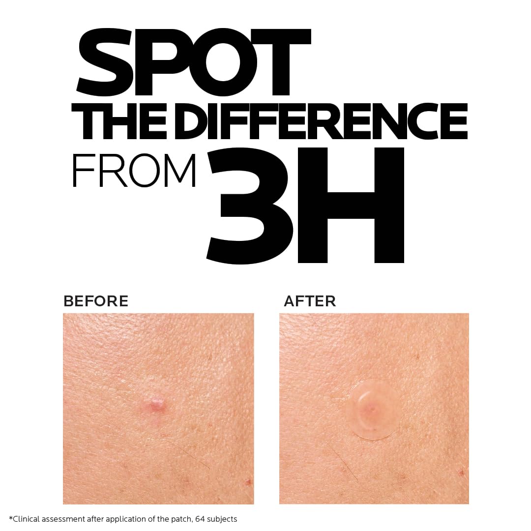 Before and after image showing La Roche-Posay Effaclar Duo acne patches reducing blemishes visibly