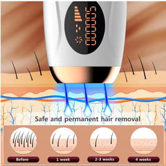 Laser Epilator IPL Hair Removal – Permanent, Painless Hair Remover for Women