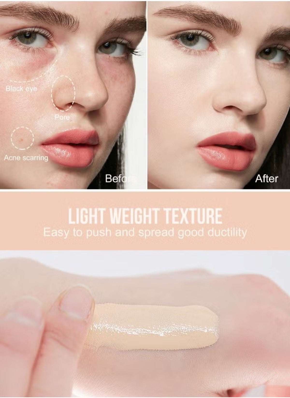 Huitich long lasting concealer for flawless skin showing before and after acne scarring coverage with lightweight texture