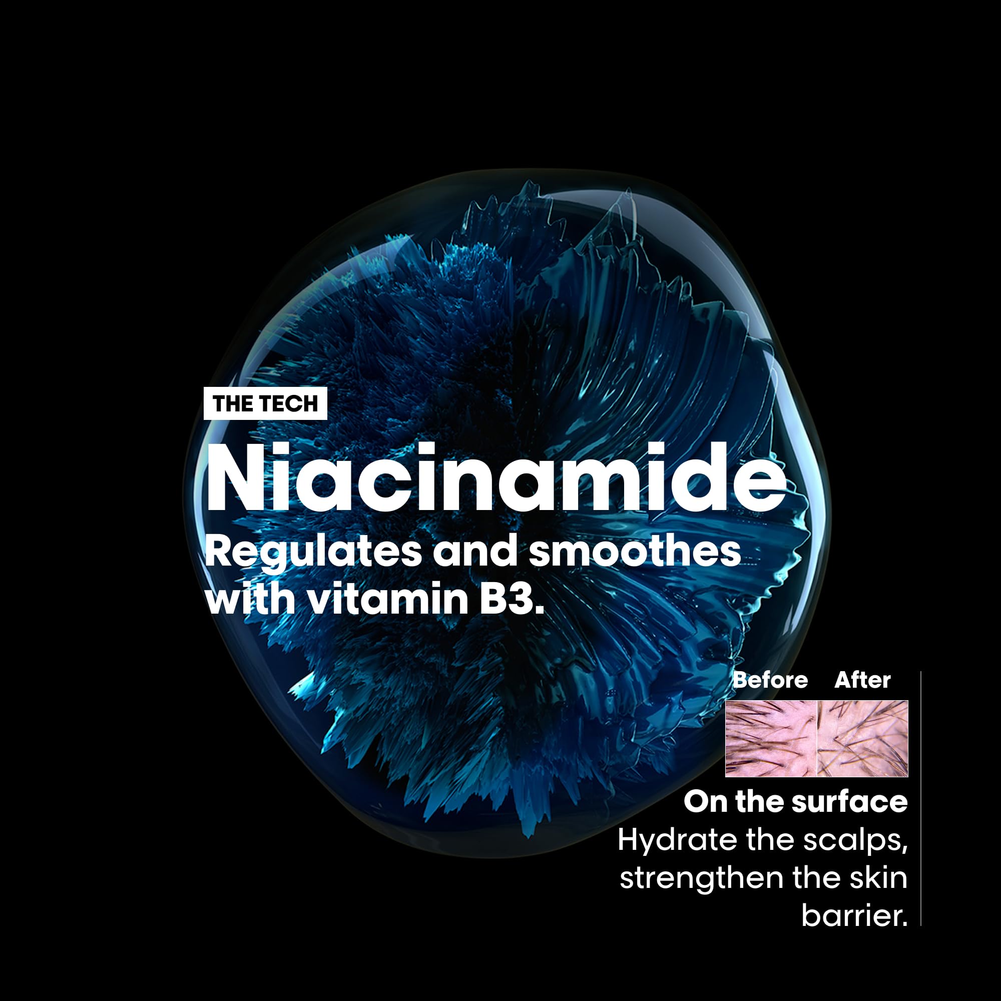 L’Oréal Professionnel anti-discomfort shampoo for sensitive scalp with niacinamide for hydration and smoothing