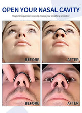 Magnetic nasal expansion strip before-and-after photos with nose airflow support