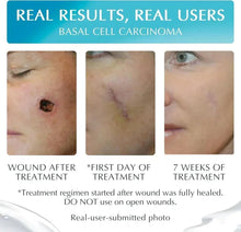 Scar treatment results panel with three skin close-ups and treatment timeline text