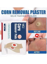 Corn removal plaster kit with pack and two pads, before-and-after callouts