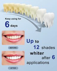 teeth whitening kit UAE showing shade guide arrow and before and after smile images claiming up to 12 shades