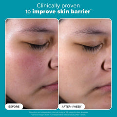 Exfoliant skin barrier before-and-after face photos, eyes closed
