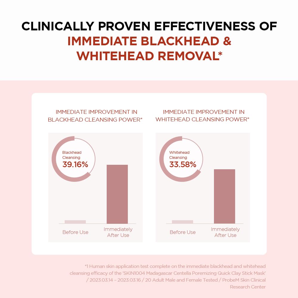Chart showing clinically proven immediate blackhead and whitehead removal effectiveness of pore minimizing face mask stick