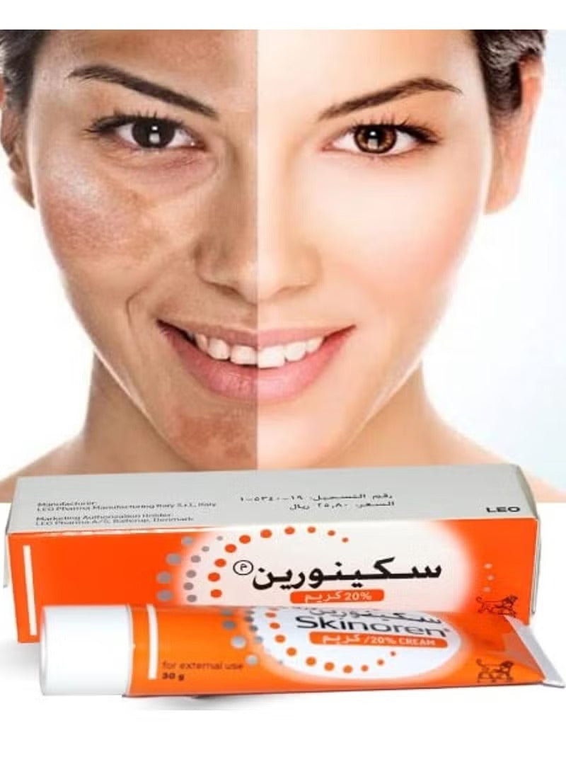 Skinoren Azelaic Acid Acne Treatment Cream for effective skin clarity and acne control