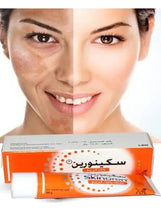 Skinoren azelaic acid cream, 30 g box with orange and white tube