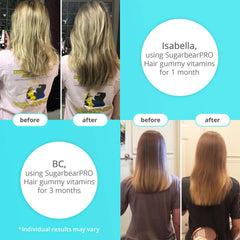 SugarBearHair before and after collage showing improved hair growth after using vegan hair vitamins gummies