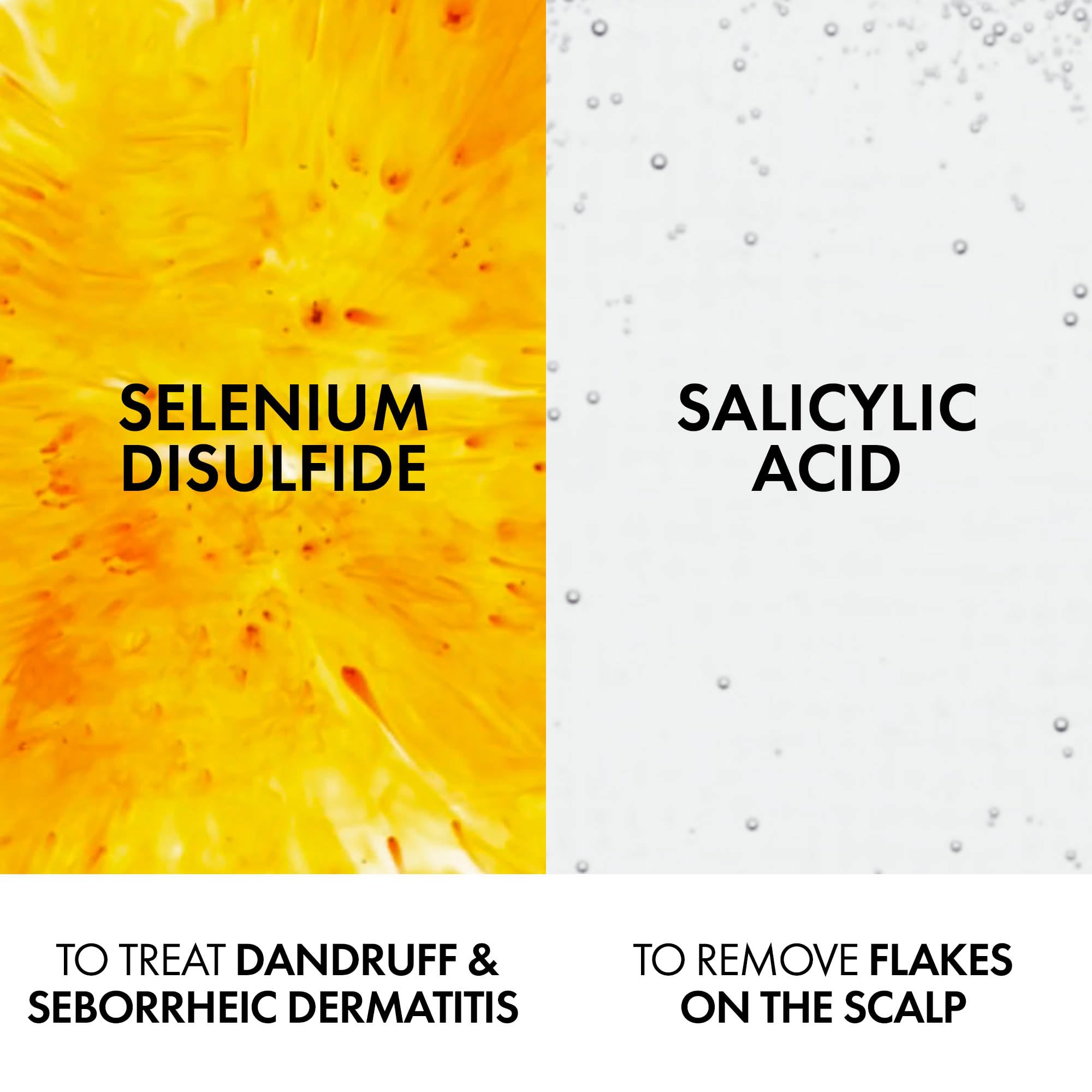 Vichy Dercos anti dandruff shampoo highlighting active ingredients Selenium Disulfide and Salicylic Acid