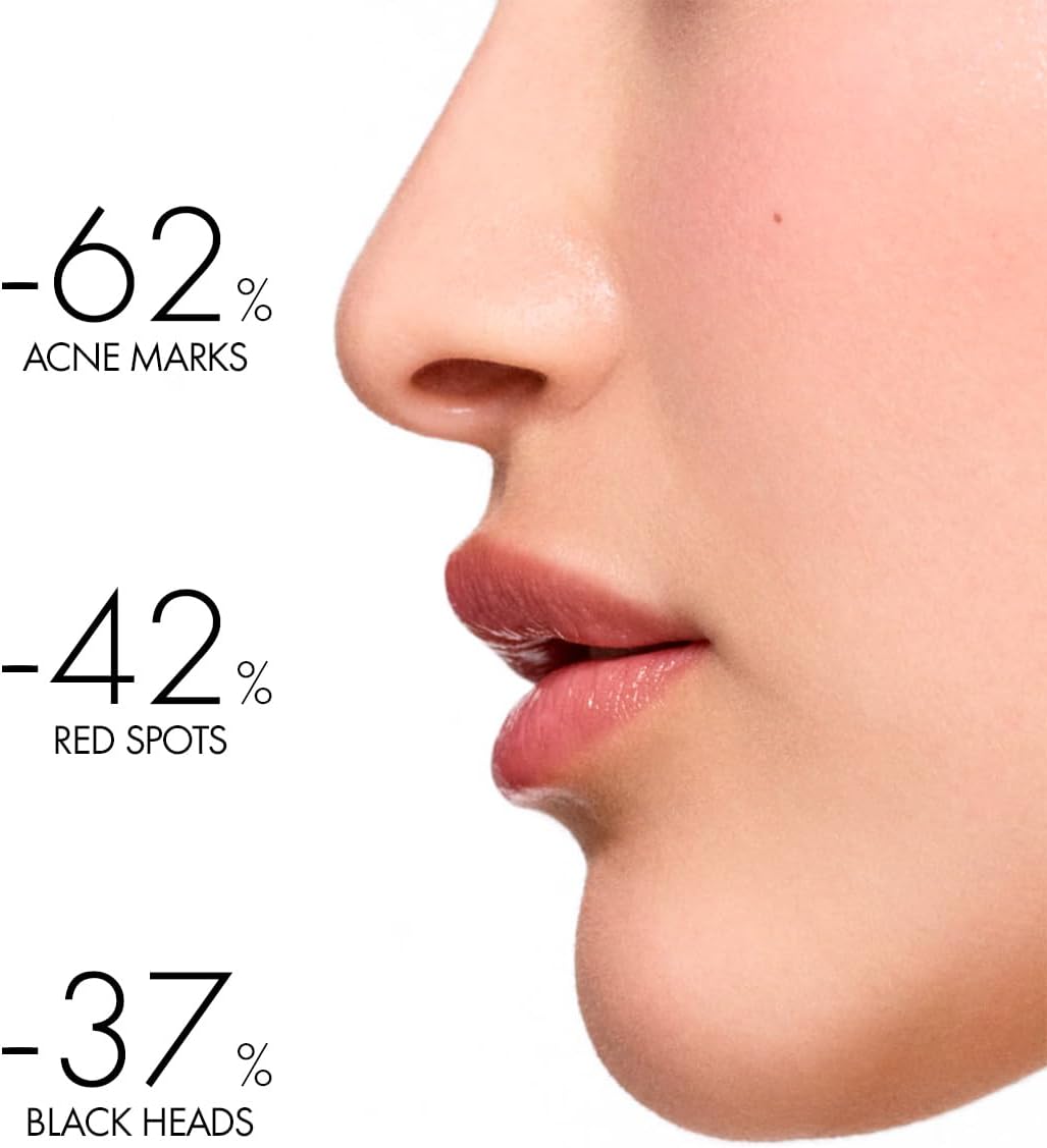 Before and after results showing improvement in skin with Vichy Phytosolution Dual Moisturizer for oily skin