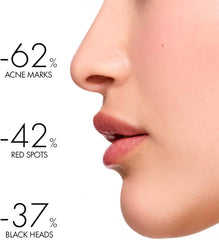 Before and after results showing improvement in skin with Vichy Phytosolution Dual Moisturizer for oily skin