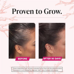 Side by side before and after showing fuller hairline after 90 days using Viviscal hair growth supplement for women