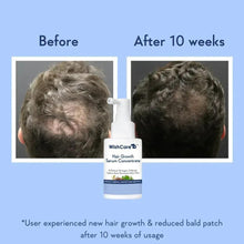 WishCare Hair Growth Serum Concentrate bottle shown with before and after 10 weeks
