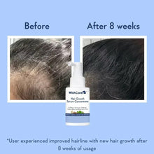 WishCare Hair Growth Serum Concentrate bottle shown with before and after 8 weeks