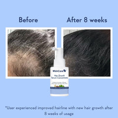 WishCare Hair Growth Serum UAE bottle with before and after results showing improved hairline after 8 weeks
